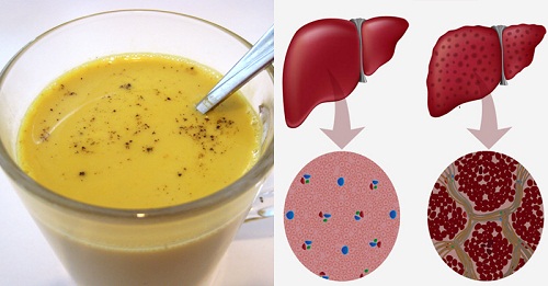Obtener una completa desintoxicación del hígado en una semana con esta receta 